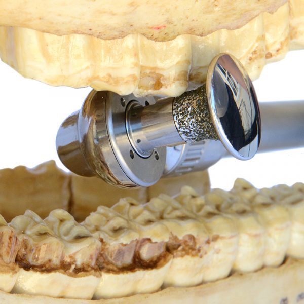 DYNAMIC Buccal Burr 25mm X 25mm (Descending to 12mm) - Image 3